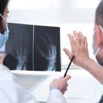 Osteoartrosi mani: cosa c’è da sapere